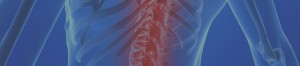 Spinal Cord Injury
