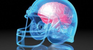 NFL Concussions