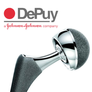 Depuy Hip Implant